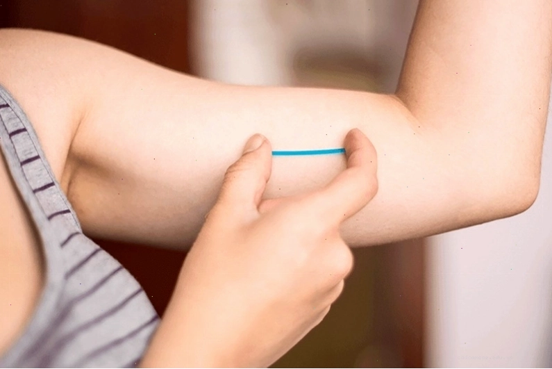 Bác sĩ đang tư vấn cho bệnh nhân về các biện pháp tránh thai
