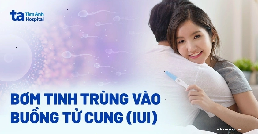 Bơm tinh trùng vào buồng tử cung là kỹ thuật hỗ trợ sinh sản tiên tiến.