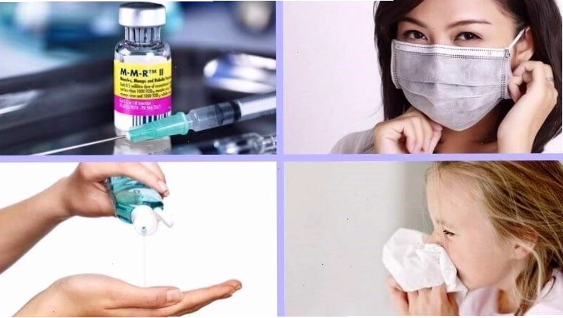 Các cách phòng ngừa bệnh quai bị hiệu quả, bao gồm tiêm vắc-xin và giữ vệ sinh