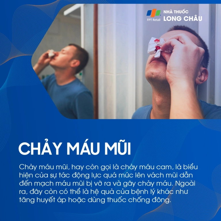 Chảy Máu Mũi: Nguyên Nhân, Cách Xử Lý và Phòng Ngừa Hiệu Quả