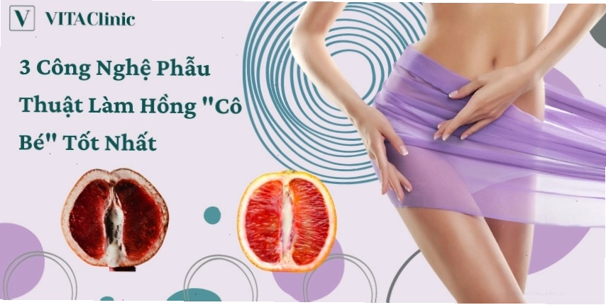Công nghệ Laser làm hồng vùng kín tại VITA Clinic