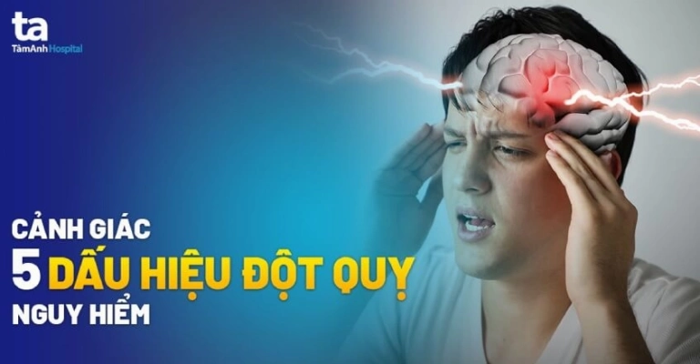 Dấu hiệu đột quỵ và cách nhận biết sớm hiệu quả