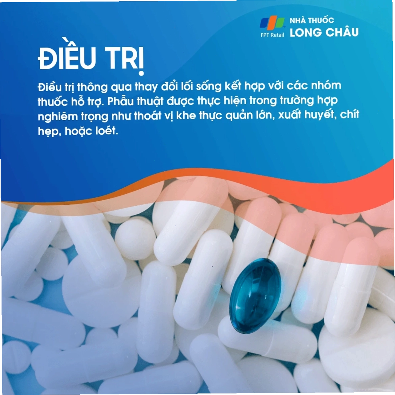 Điều trị trào ngược dạ dày bằng thuốc và thay đổi lối sống.
