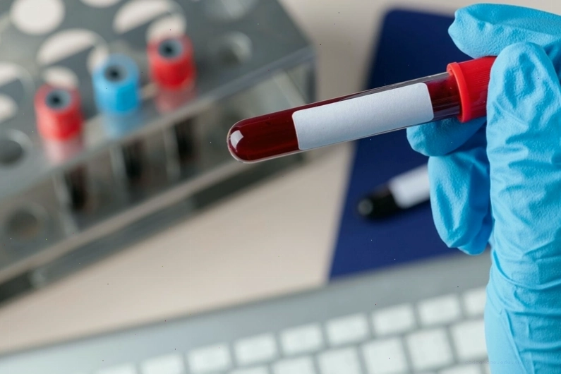 Độ chính xác của Double test phụ thuộc vào nhiều yếu tố