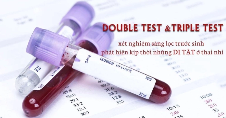 Double test: Tất cả những gì bạn cần biết về xét nghiệm quan trọng này