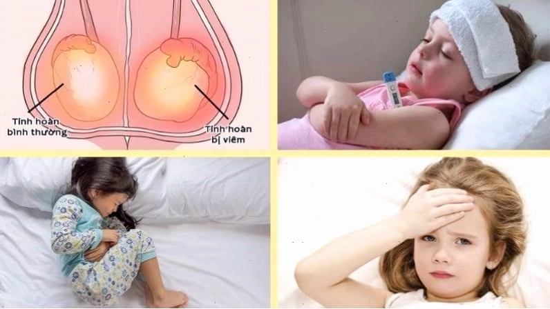 Hình ảnh các dấu hiệu cần gặp bác sĩ khi bị quai bị