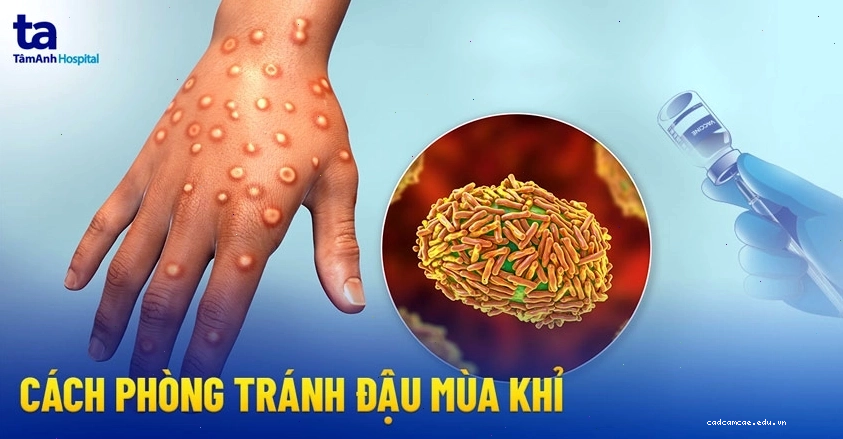 Hình ảnh khuyến cáo các biện pháp phòng tránh bệnh đậu mùa khỉ