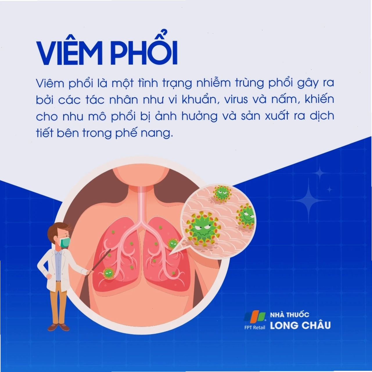 Hình ảnh minh họa bệnh viêm phổi với các triệu chứng điển hình
