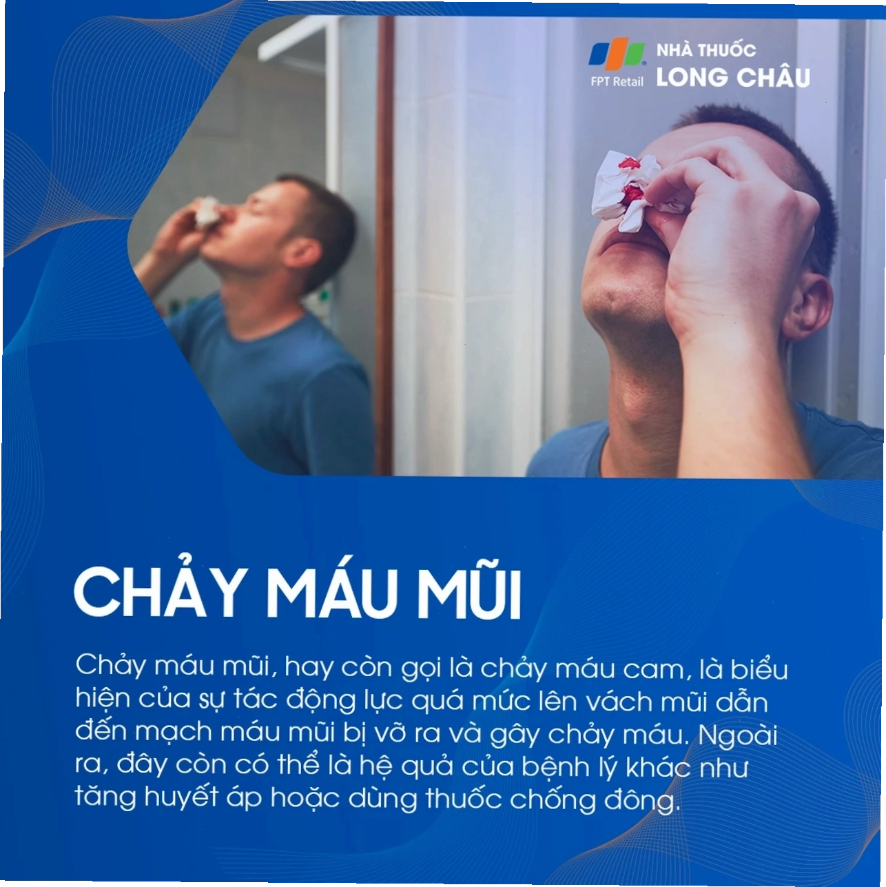 Hình ảnh minh họa chảy máu mũi do tăng huyết áp hoặc dùng thuốc chống đông