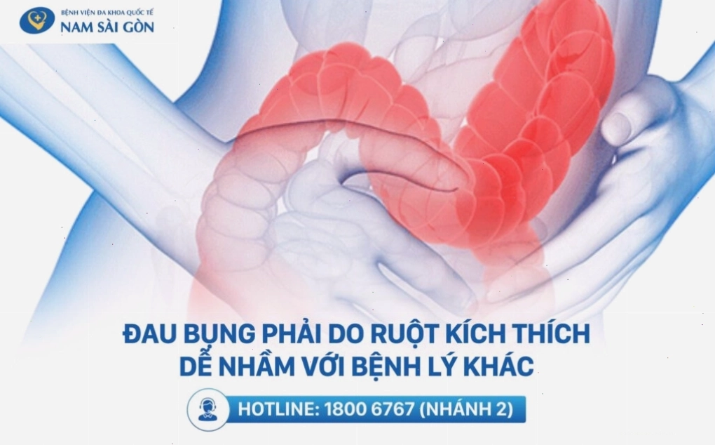 Hình ảnh minh họa cơn đau bụng dưới bên phải, cần chú ý để phát hiện sớm các bệnh lý