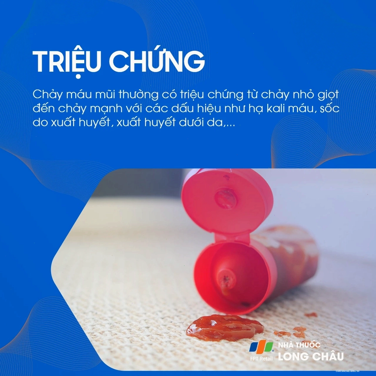 Hình ảnh minh họa dấu hiệu nguy hiểm khi chảy máu mũi