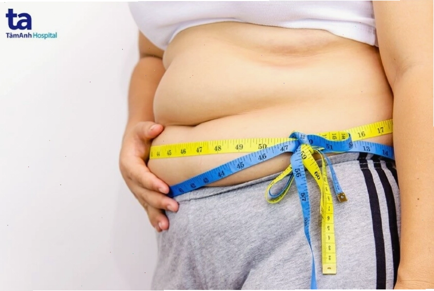Hình ảnh minh họa người béo phì với nguy cơ đột quỵ cao