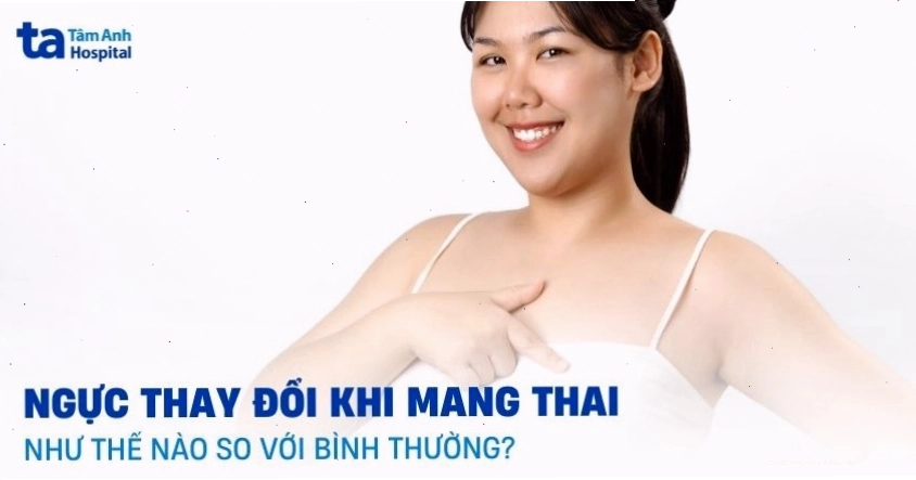 Hình ảnh minh họa sự thay đổi của bầu ngực trong thai kỳ