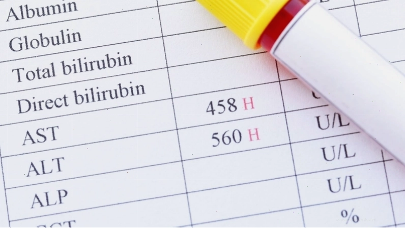 Hình ảnh minh họa tình trạng tăng men gan, cho thấy nồng độ enzyme gan trong máu cao hơn mức bình thường