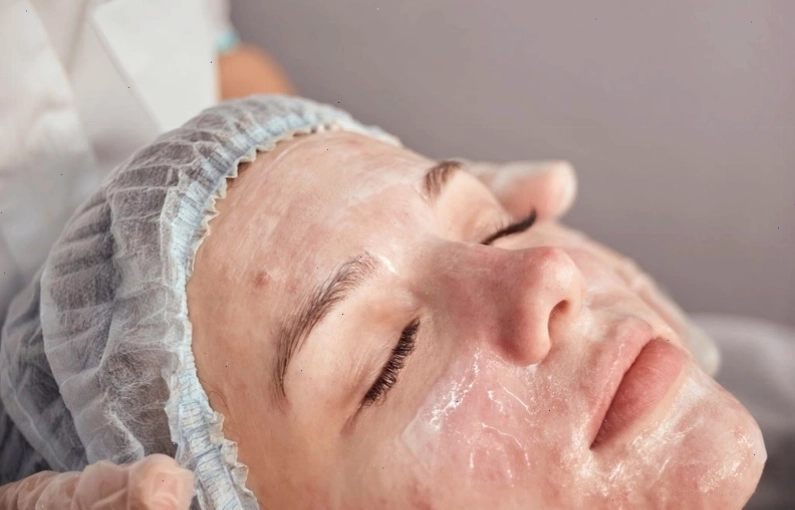 Lựa chọn sản phẩm chăm sóc da phù hợp cho da mụn viêm