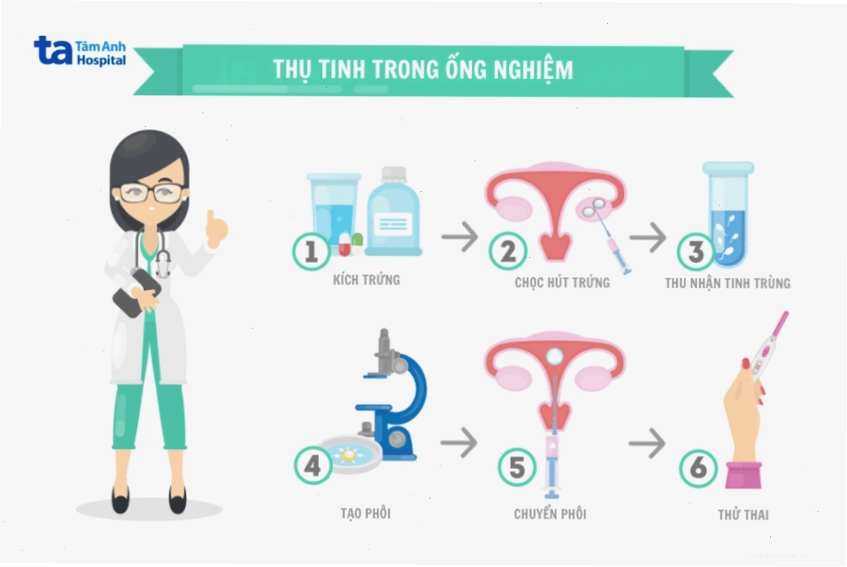 Minh họa các bước trong quy trình làm thụ tinh ống nghiệm IVF