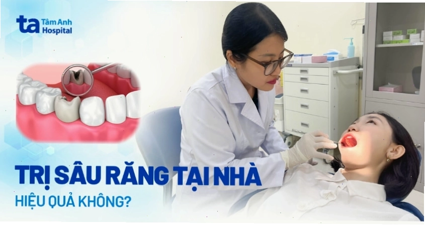 Minh họa các phương pháp chăm sóc răng miệng tại nhà có thể hỗ trợ giảm triệu chứng sâu răng