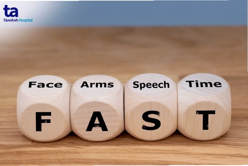 Minh họa quy tắc FAST nhận biết dấu hiệu đột quỵ