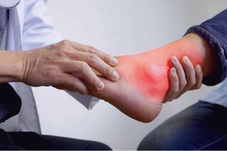 Minh họa tình trạng sưng phù chân, một tác dụng phụ của thuốc