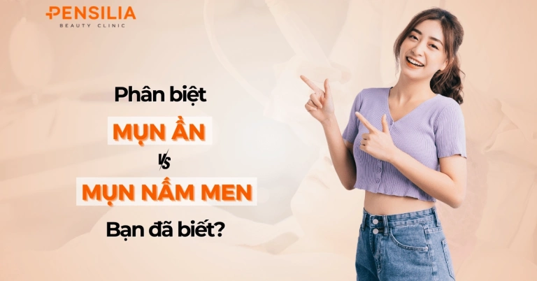 Nhận diện và điều trị mụn nấm men: Hướng dẫn chi tiết