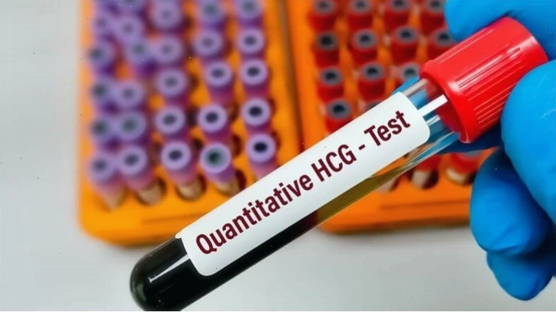 Nồng độ HCG thấp là một trong những nguyên nhân dẫn đến hiện tượng có thai nhưng thử que 1 vạch