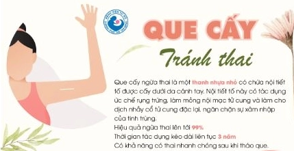 Que cấy tránh thai: Giải pháp hiệu quả và những điều cần biết