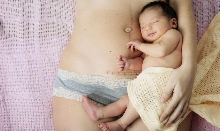 Sinh mổ bao lâu thì quan hệ được? Lưu ý sức khỏe mẹ và bé