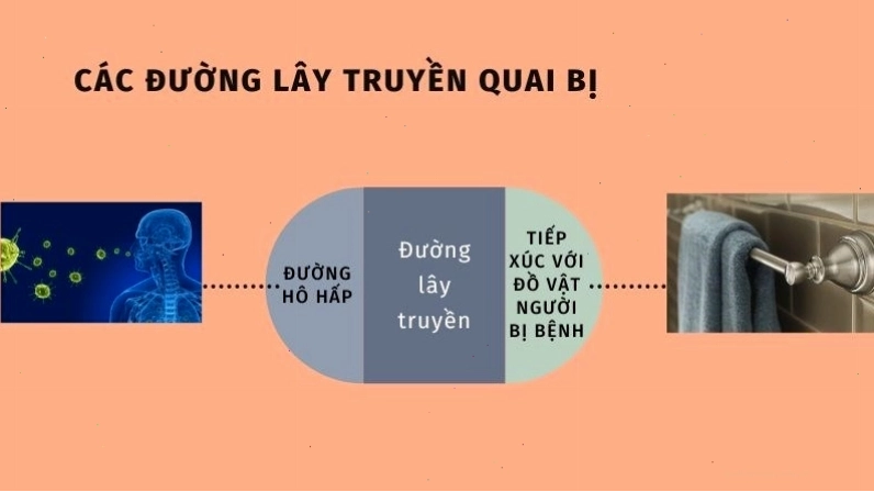 Sơ đồ minh họa các đường lây truyền của virus quai bị trong cộng đồng