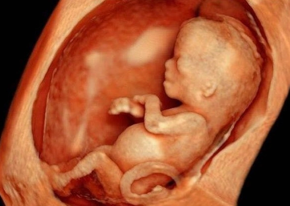 Thai lưu là gì: Nguyên nhân, dấu hiệu và cách phòng tránh