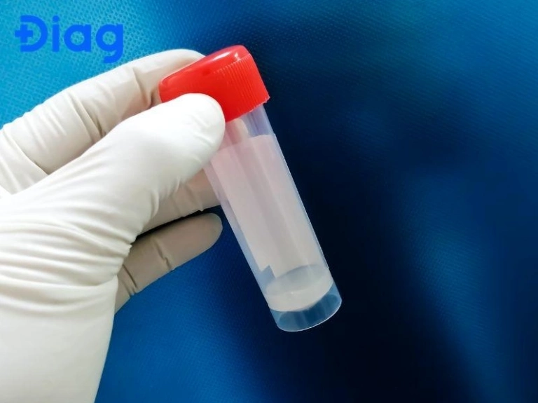Tinh trùng có màu gì là tốt? Giải đáp thắc mắc về màu sắc tinh dịch