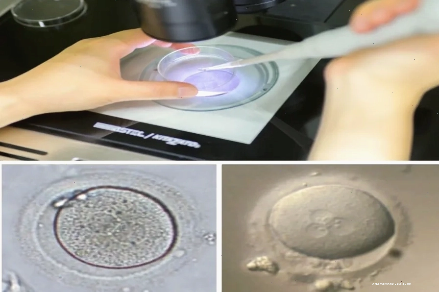 Trứng và tinh trùng sẽ được thụ tinh trong phòng Lab để tạo phôi trong khoảng 3-6 ngày