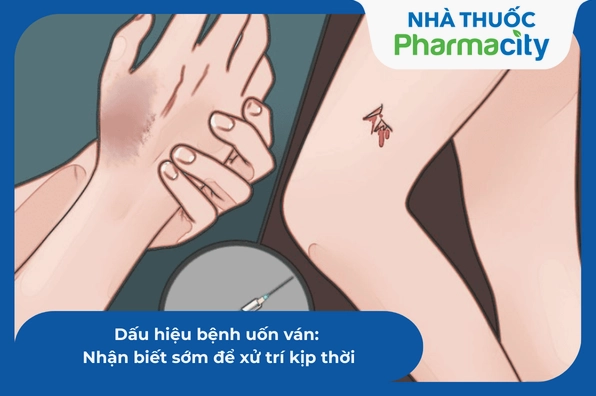 Uốn ván dấu hiệu nhận biết và phòng ngừa hiệu quả