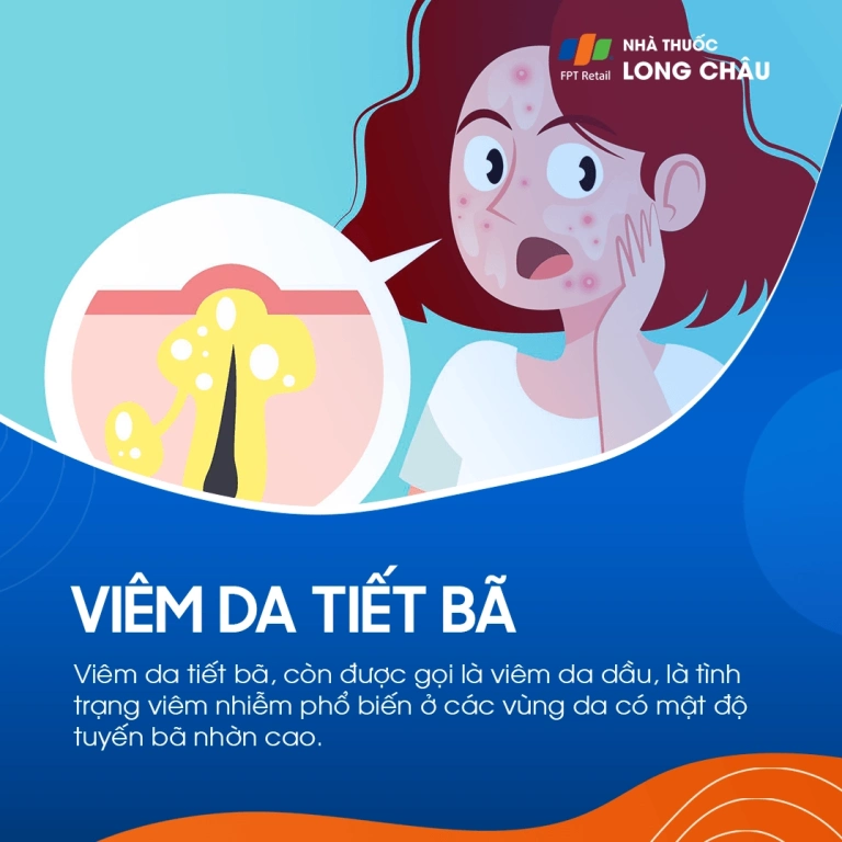 Viêm Da Tiết Bã Da Đầu: Nguyên Nhân, Triệu Chứng và Cách Điều Trị Hiệu Quả