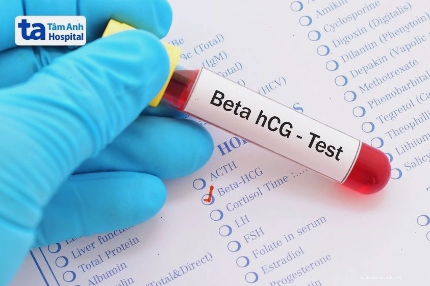 Xét nghiệm beta hcg là phương pháp y tế giúp xác định tình trạng mang thai