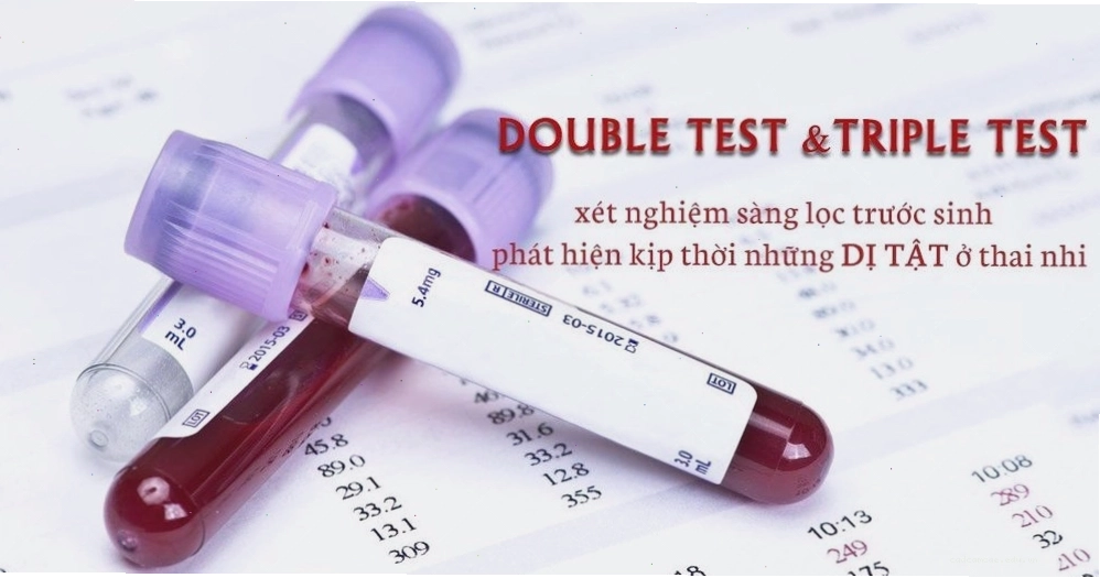 Xét nghiệm Double test giúp phát hiện sớm các nguy cơ bất thường ở thai nhi