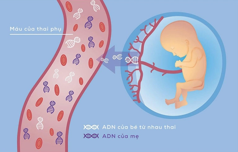Xét nghiệm NIPT là gì? Giải đáp thắc mắc và những ưu điểm vượt trội