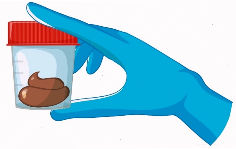 Xét nghiệm phân giúp phát hiện nhiều loại ký sinh trùng đường ruột